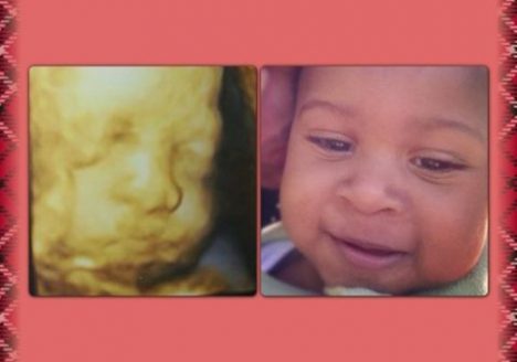 blogger-image-1486718369